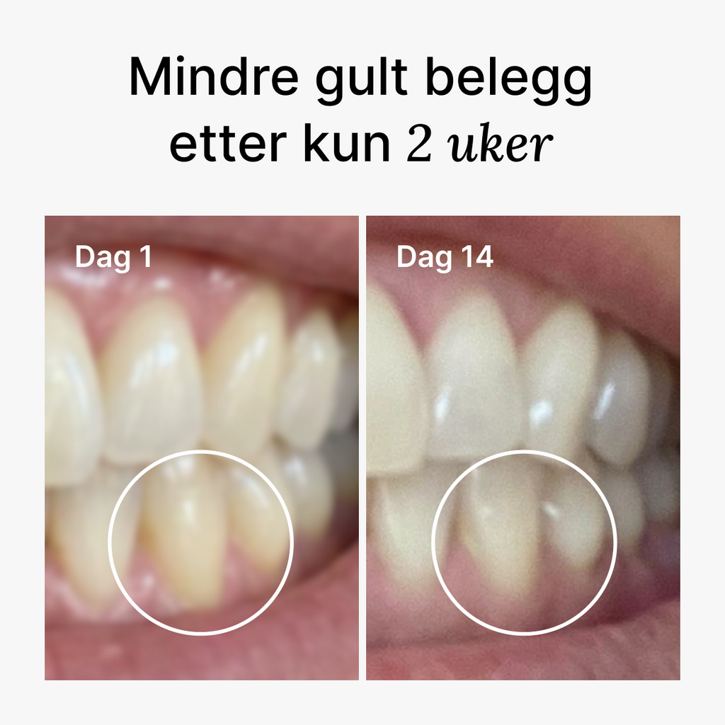 D2 Pro Sonisk Elektrisk Tannbørste